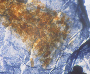 Closeup of the contents of a springtail gut. You can see the large brown fungal spores the blue springtail has been feeding on.