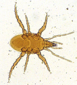 Predatory mite. Note long legs for fast mobility compared with decomposer mites.