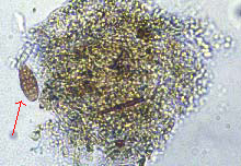 Springtail faeces. Note the fragmented leaf and arrow pointing to fungal spore.