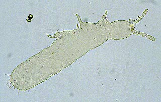 A soil dwelling springtail with no dark eyespots.